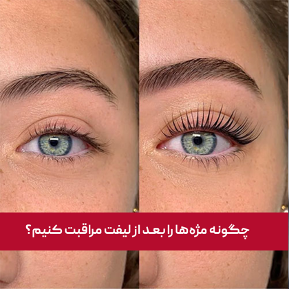 چگونه مژه‌ها را بعد از لیفت مراقبت کنیم؟